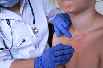 The doctor is examining the child's skin for signs of illness.