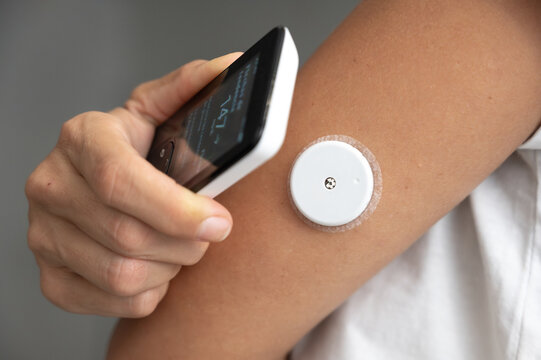 Patient applying continuous glucose monitoring sensor and checking blood sugar level