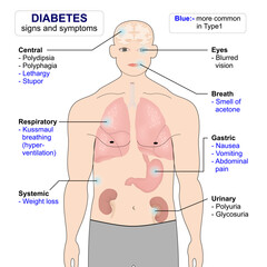 Symptoms and sign of diabetes