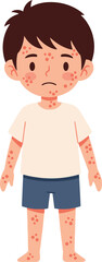A cartoon boy stands with a sad expression, covered in red spots, likely indicating a rash or skin condition.