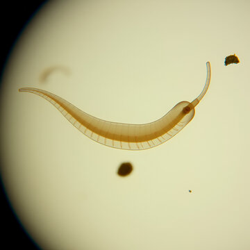 Planarian parasite (flatworm) under microscope view.