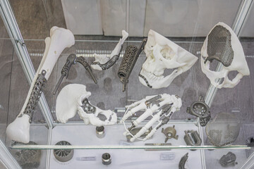 Close-up of 3D printed titanium dentures, displayed in a museum exhibit showcasing human skeletal...