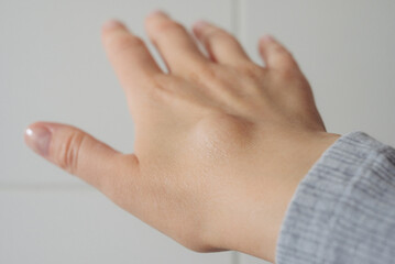Female right back hand with ganglion cyst on the dorsum,  fluid-filled bump associated with a joint or tendon sheath, close-up view, selected focus.