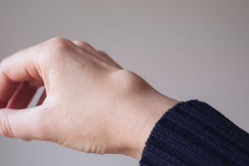 Female right back hand with ganglion cyst on the dorsum,  fluid-filled bump associated with a joint or tendon sheath, close-up view, selected focus.