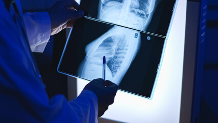 X-ray. Close-up X-ray. Chest. High-quality photo.