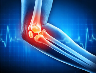 Ellbogengelenk mit schmerzen - 1