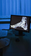 X-ray. Close-up X-ray. Foot X-ray. High-quality photo.