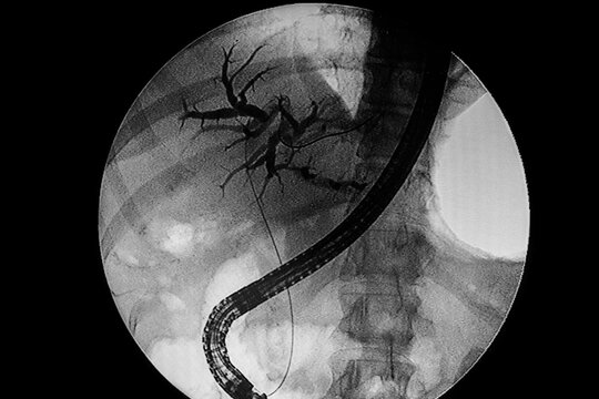 Medical themes: Endoscopic retrograde cholangiopancreatography (ERCP)
