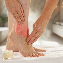 Woman gently massaging sore legs and ankle, focusing on pain relief and relaxation, muscle fatigue,...