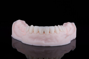 Quality dental zirconium crowns of lower jaw stylized as young bright teeth on 3D printed model.