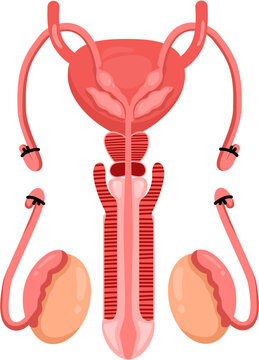 Vasectomy 
