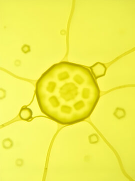 Plasmolysis in a plant cell. Process of contraction or shrinkage of the protoplasm of a plant cell. Plant cells under osmotic conditions.