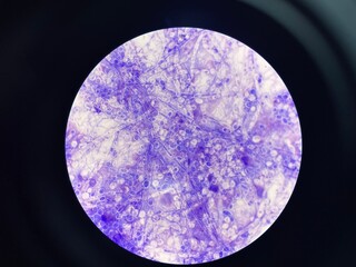 Budding is a form of asexual reproduction, where the new cell develops as an outgrowth from the...