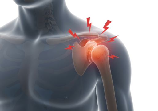 Isolated Shoulder Joint with Red Pain Signals for Healthcare