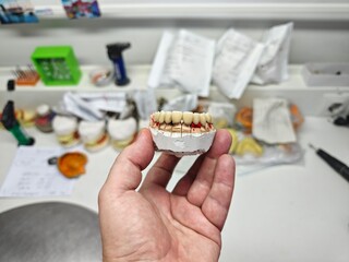 metal-ceramic artificial dentures in the hands