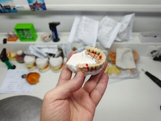 metal-ceramic artificial dentures in the hands