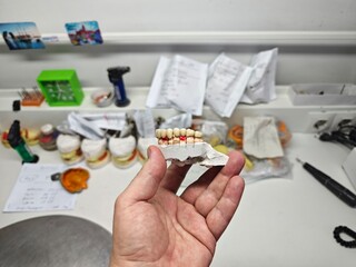 metal-ceramic artificial dentures in the hands
