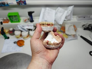 metal-ceramic artificial dentures in the hands