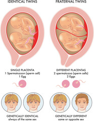 Illustration shows the difference between identical twins and fraternal twins, and why this happens, with annotations.