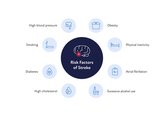 Brain neural disease for healthcare infographic. Vector flat illustration. Icon outline set of risk factors of stroke for poster. Design for health care