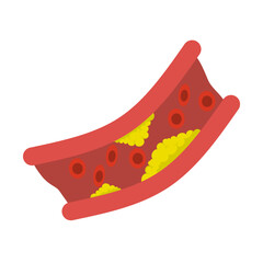 Vector illustration of clogged blood vessels, cholesterol, and fatty deposits on a white background