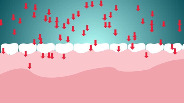 Wisdom teeth with holes cartoon style. Cartoon teeth and gums. Arrows are pointing at gums and teeth. Cartoon animation