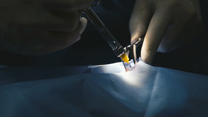 Surgical hands performing septoplasty procedure with precision instruments on a patient, showcasing...