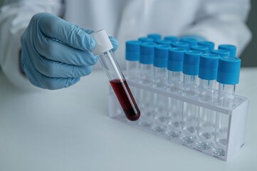 Medical lab blood test sample tubes laboratory analysis - clinical testing healthcare diagnostics pathology medical examination blood work specimen collection laboratory technician
