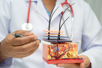 Hair transplant, Asian dermatologist doctor holding skin structure anatomy model for treatment in...