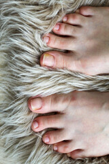 Natural toenails on soft furry carpet — real feet close-up with yellow nail discoloration visible on both big toes.