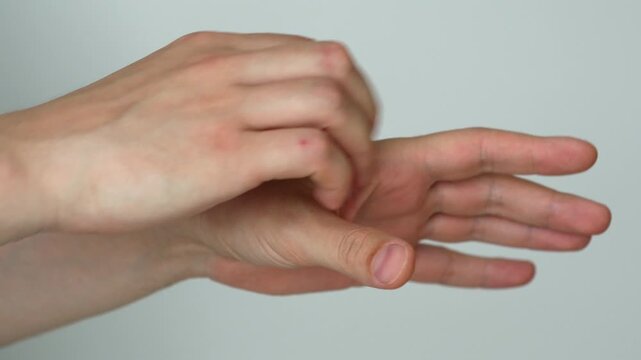Itching of a man's hand after an insect bite.
Malaria and mosquito bite.
Scabies and skin problems.
Eczema and inflammation of the skin on the hand.
Concept of medicine and health care