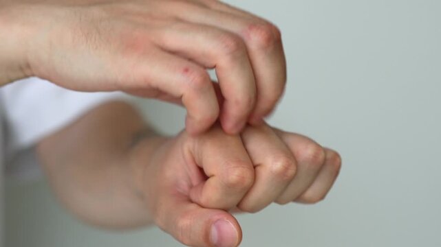 Man scratching an itchy spot on his arm.
Itching and allergy on the arm.
Man experiencing discomfort from severe itching and scabies on a white background