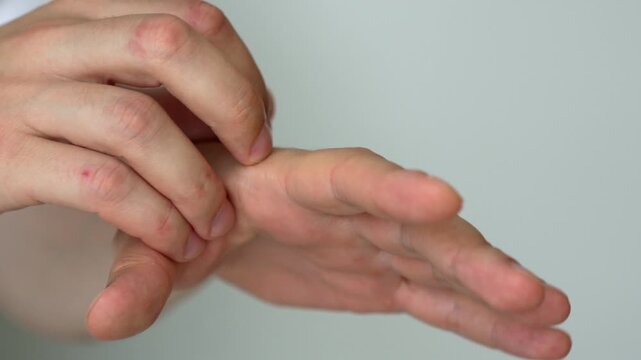 Man scratching an itchy spot on his arm.
Itching and allergy on the arm.
Man experiencing discomfort from severe itching and scabies on a white background