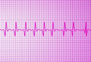 Pink EKG paper background, ready for heart rate recording,  ECG,  cardiology