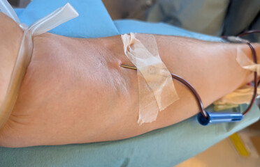 blood donors during collection with a tourniquet tightly constri