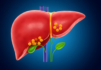 Anatomical diagram of the liver and gallbladder, highlighting internal medical components.

