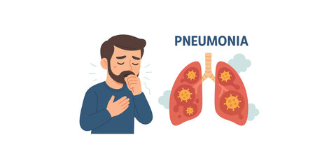 Print  Pneumonia disease illustration