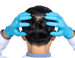 Fototapeta premium A person wearing blue medical gloves examines the scalp of their head, focusing on hair and skin health.