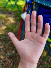 Malaysia, July 15 2026. A little cut on a hand can happen in the blink of an eye. Remember to clean and cover any injuries to keep them safe while exploring the playground.