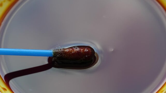 Iodine at the cotton bud. 