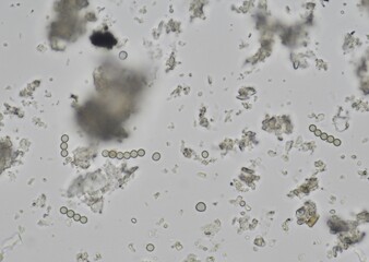 soil microorganisms under a microscope including amoeba, flagellates, nematodes, fungi, bacteria