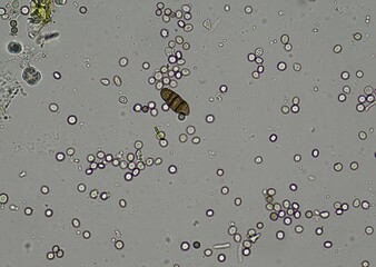 soil microorganisms under a microscope including amoeba, flagellates, nematodes, fungi, bacteria