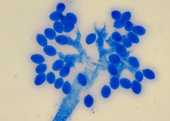 soil microorganisms under a microscope including amoeba, flagellates, nematodes, fungi, bacteria