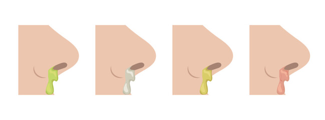 Different colors of mucus dripping from nose representing various stages of illness
