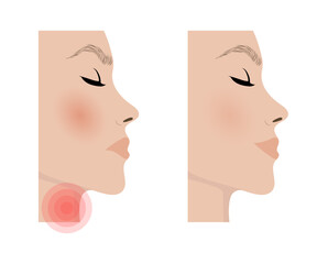 Woman suffering from sore throat and inflammation