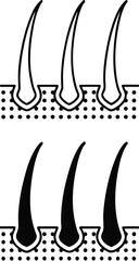 Hair Icons. Black and White Vector Illustration. Hair Bulbs, Human Body Part. Concept Anatomy

