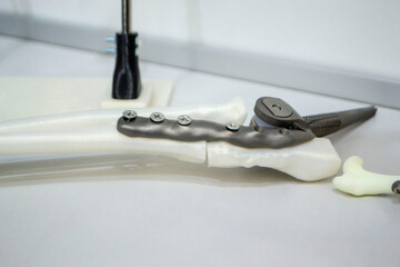 Implants and prostheses printed 3D printer from biocompatible titanium powder.