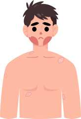 Fototapeta premium Warts