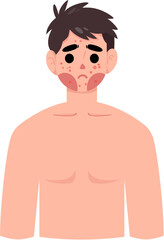 Fototapeta premium Acne skin