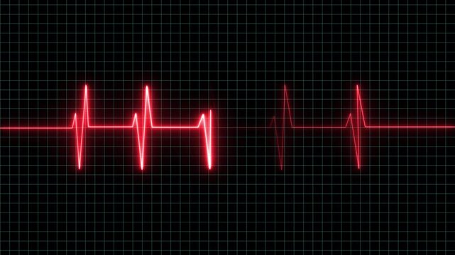 heart beat line animation on black background. medical concept Abstract glowing re heartbeat signal icon animation video. love border in hart .on the black background